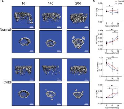 Brown Adipose Tissue Rescues Bone Loss Induced by Cold Exposure